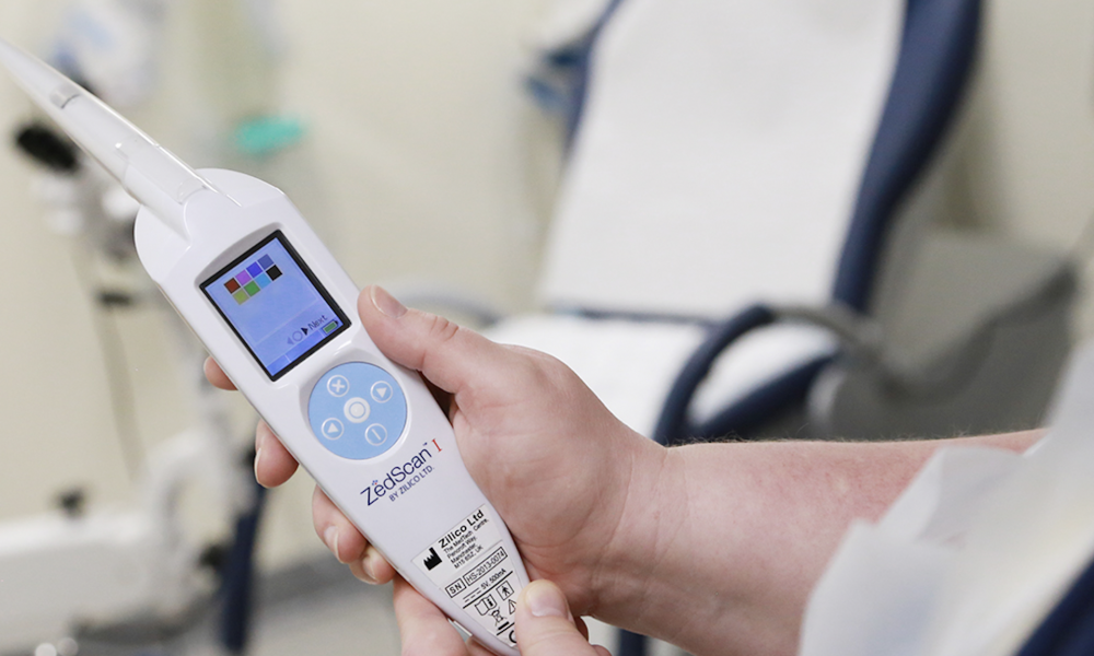 Zilico device increases cervical cancer detection by up to 24 per cent