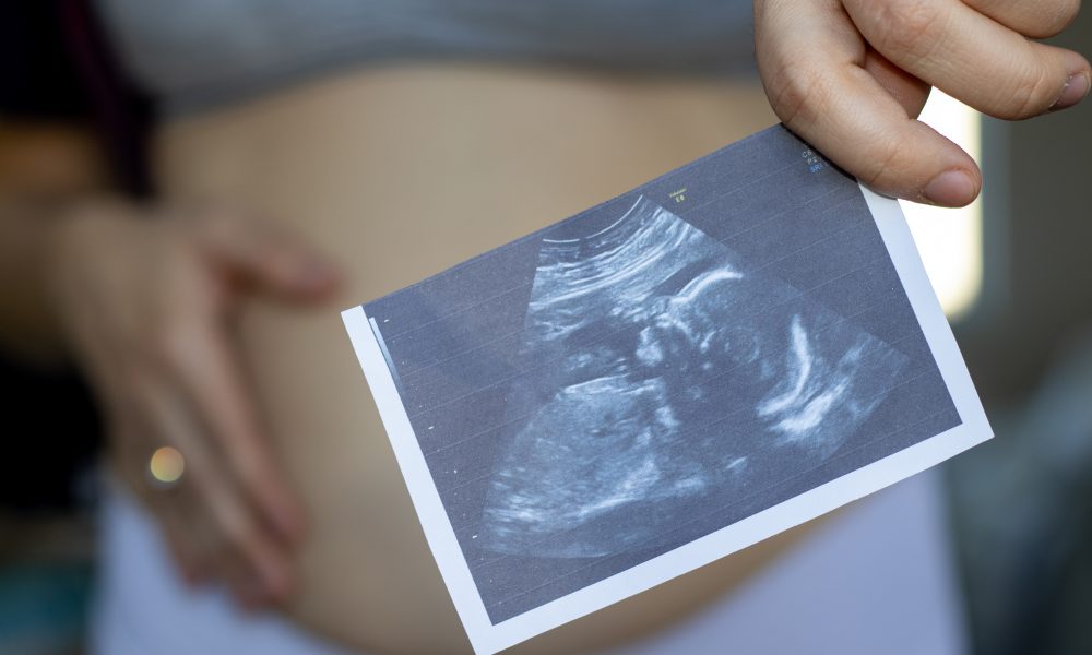 CCRM Fertility acquires The Institute for Reproductive Medicine & Science