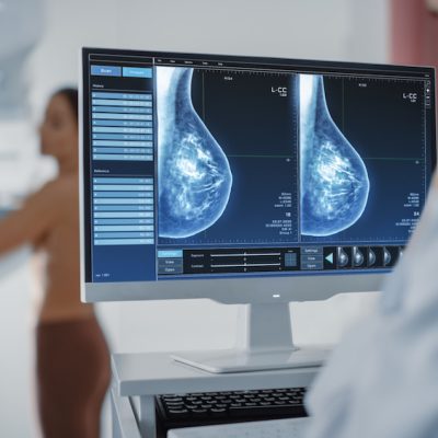 Breast cancer diagnostics AI startup raises US$2M in pre-series A funding