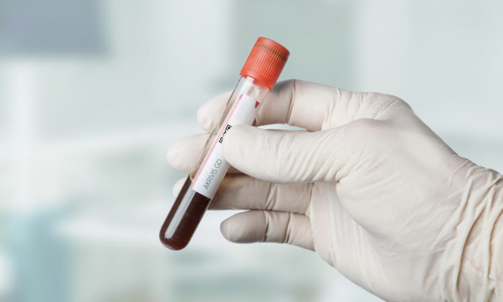 US biotech company raises US$7m for ovarian cancer diagnostic test