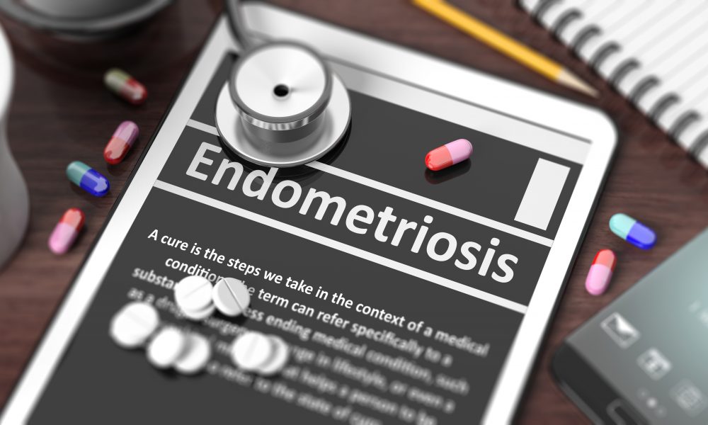 Australian academics awarded AUD$3.3m to support women with endometriosis