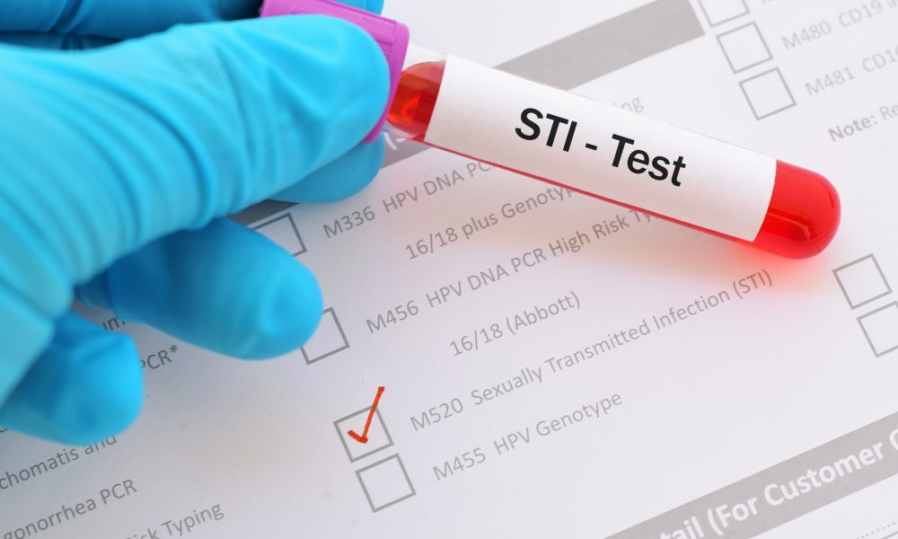 Favor teams up with imaware to provide at-home STI testing