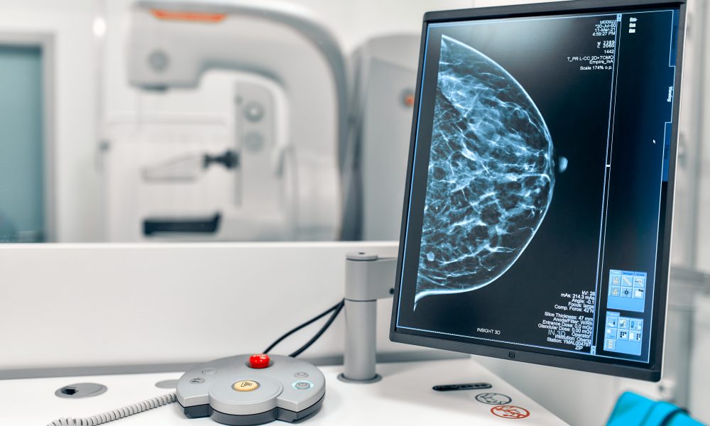 US FDA clears ‘AI-enabled’ breast cancer screening software