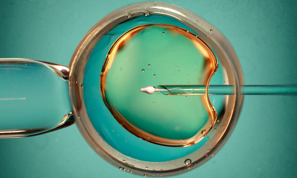 Deal could advance AI’s role in fertility services