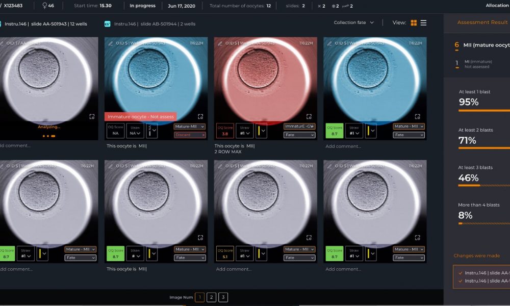 Fairtility unveils CHLOE OQ™ expanding its offering into fertility preservation