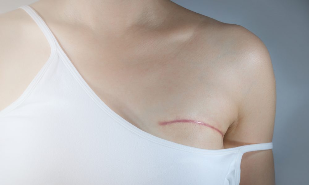 Firefighters exposed to chemicals linked with breast cancer