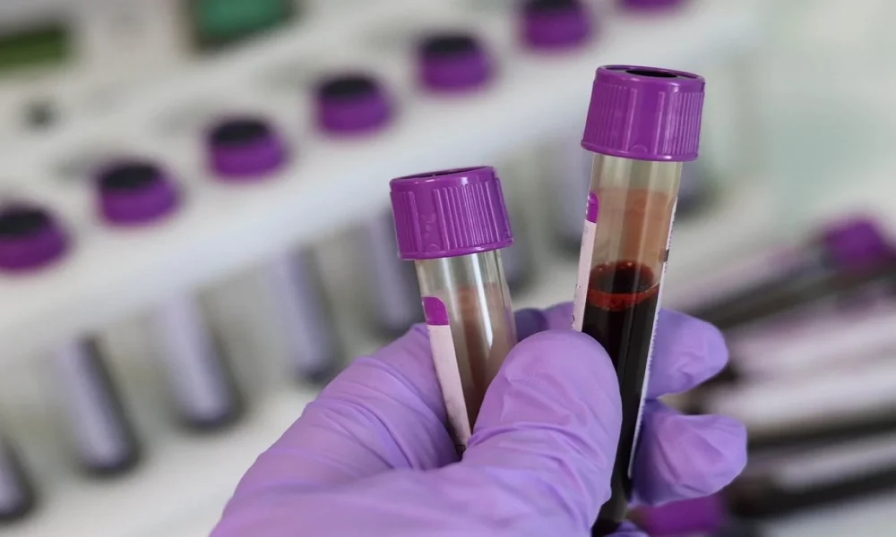 blood-thermo FDA approves novel blood tests for preeclampsia