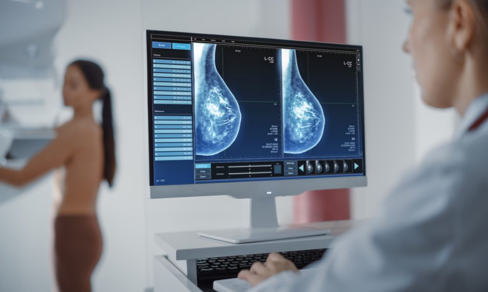 UK diagnostic imaging platform expands access to mammograms for women from the age of 40
