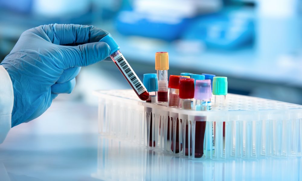 Study identifies why some breast cancers become resistant to hormone therapy