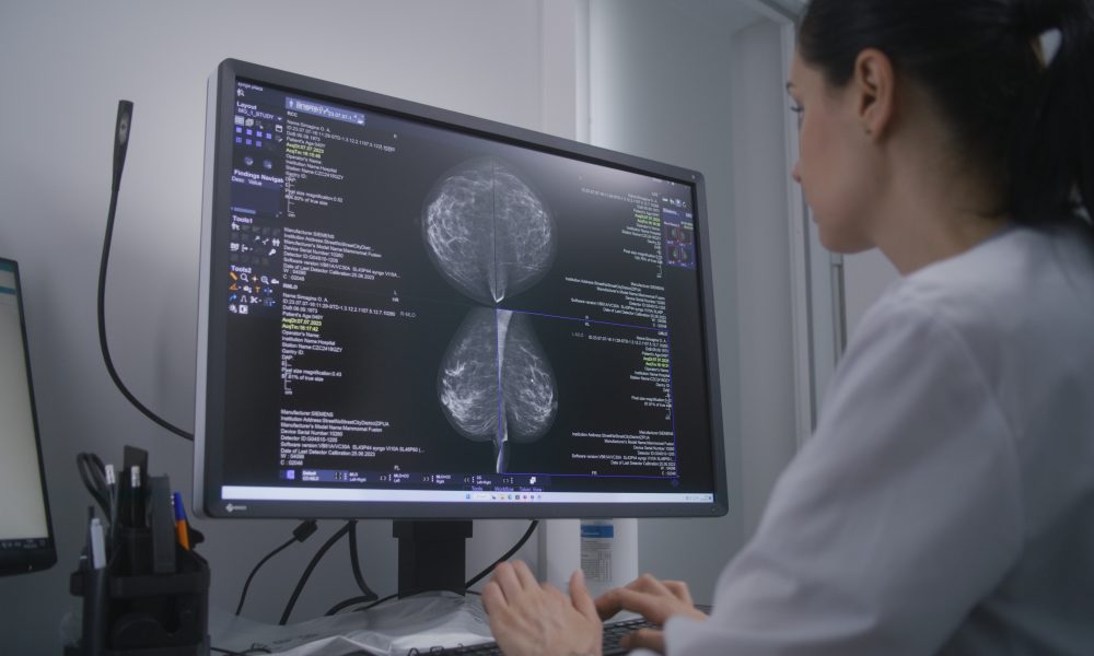 New mammography system designed to enhance screening unveiled