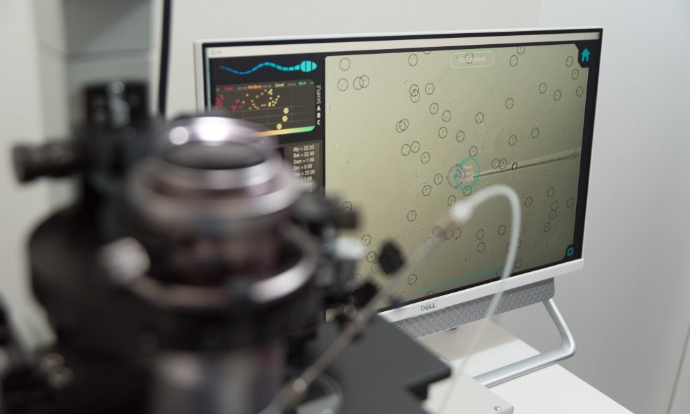 Unlocking the potential of AI in IVF: insights from a global survey