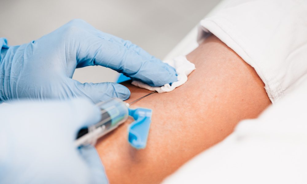 A blood test is a necessary diagnostic tool New blood test could predict if breast cancer will return years before relapse