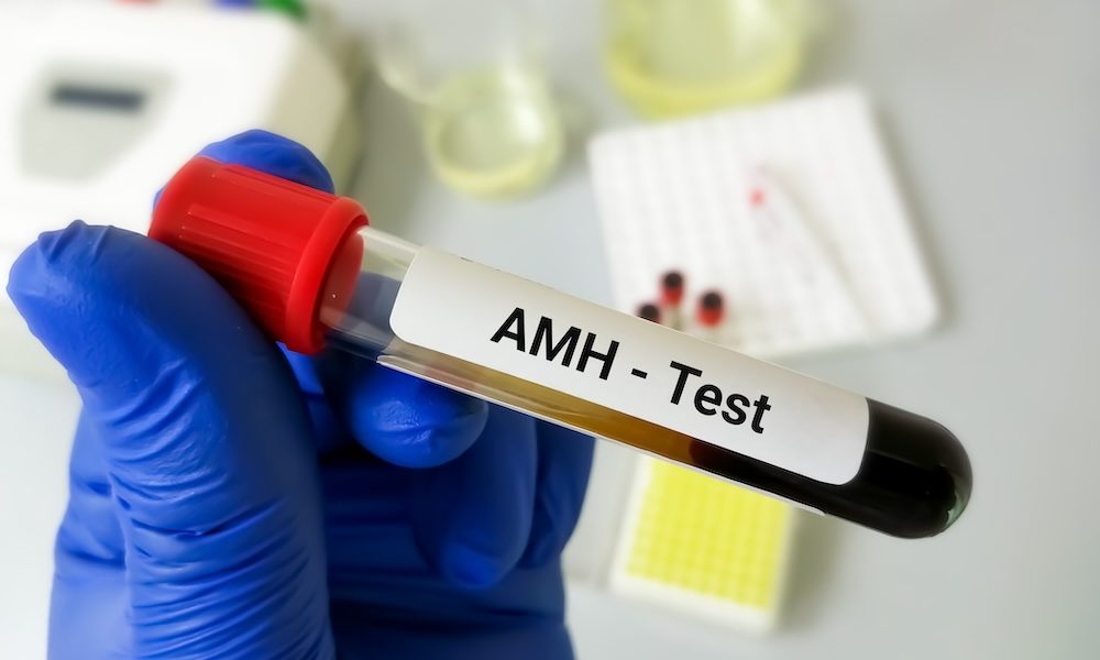Clinics selling AMH tests lure women with ‘false promises’, say ...