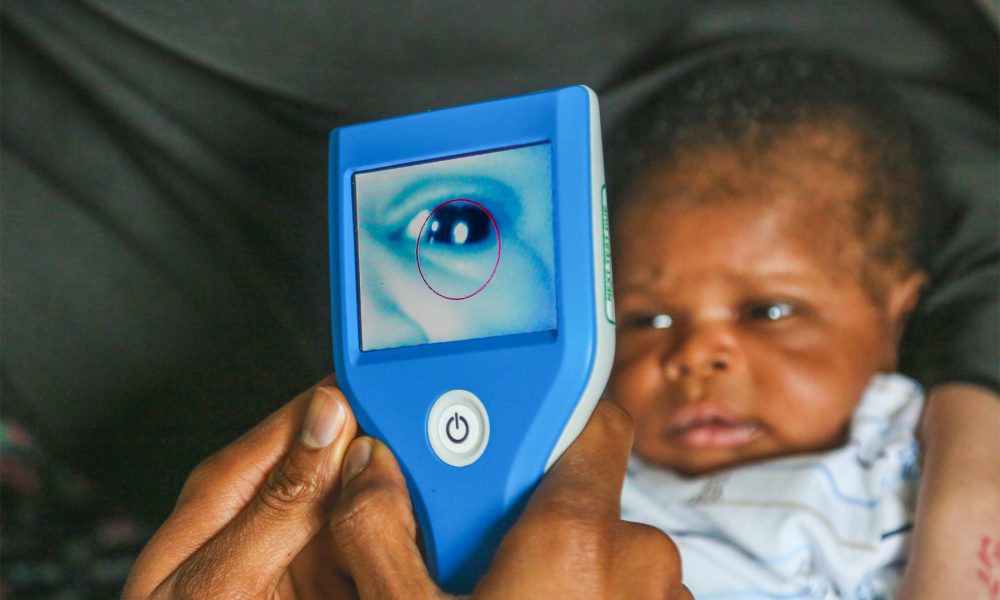 1_42 Technology_Neocam_right first time image capture Researchers to develop AI innovation to improve newborn eye screening
