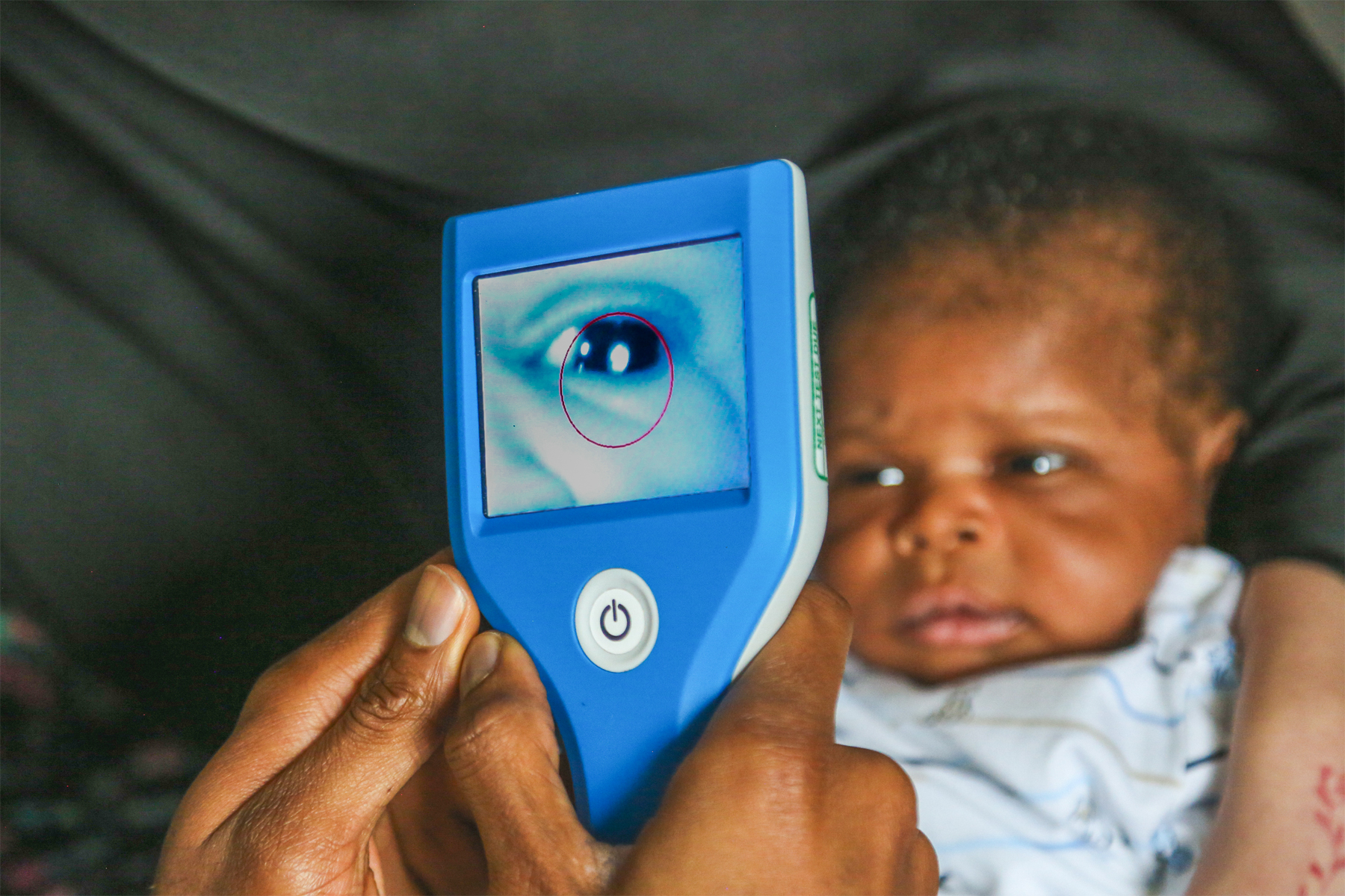 Researchers to develop AI innovation to improve newborn eye screening 