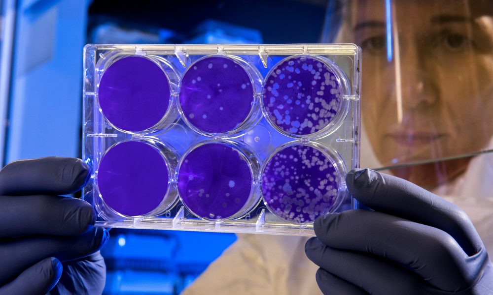 Researchers create ‘super stem cells’ that could improve fertility treatment
