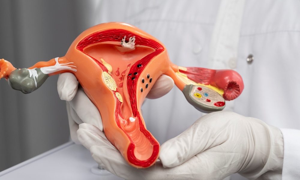 Interview: New horizons in endometriosis diagnosis