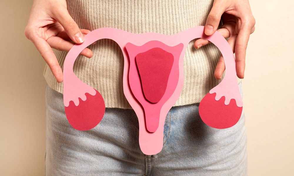 Survey calls for renaming of PCOS to better reflect condition