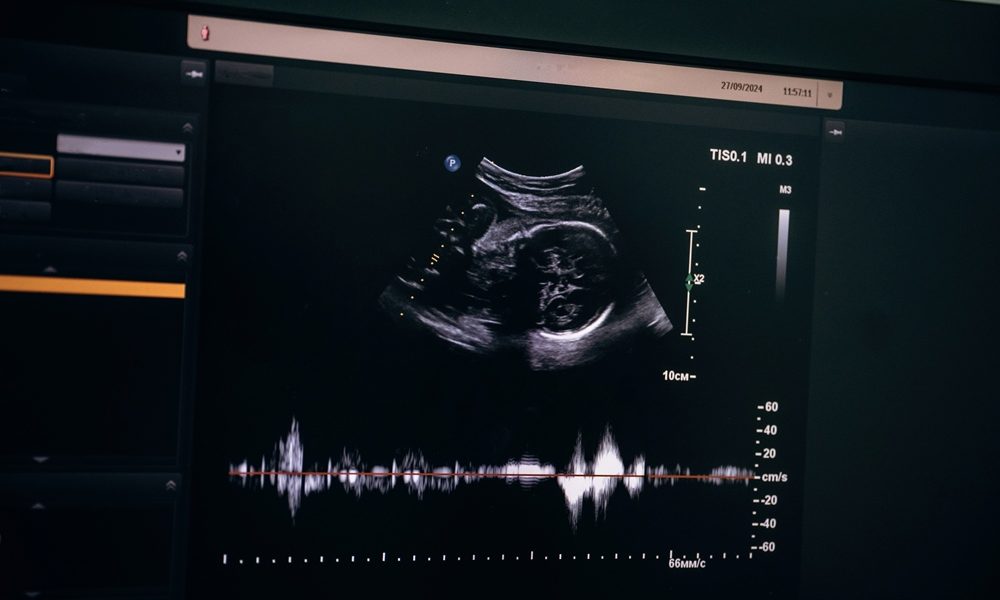 Health Secretary announces inquiry into Leeds maternity services