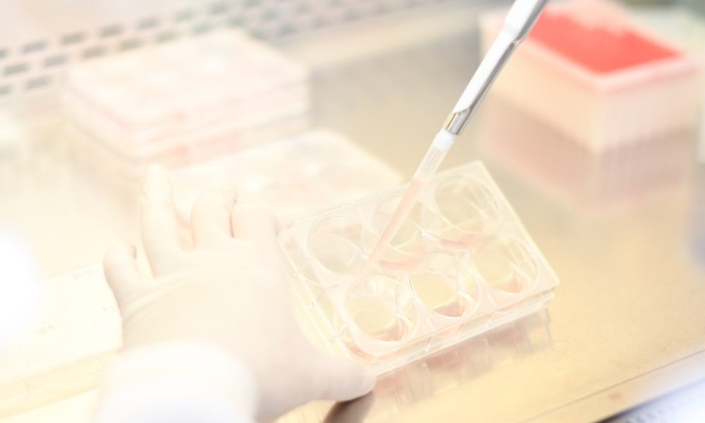 Researchers achieve first pregnancy using AI to recover sperm in infertile men