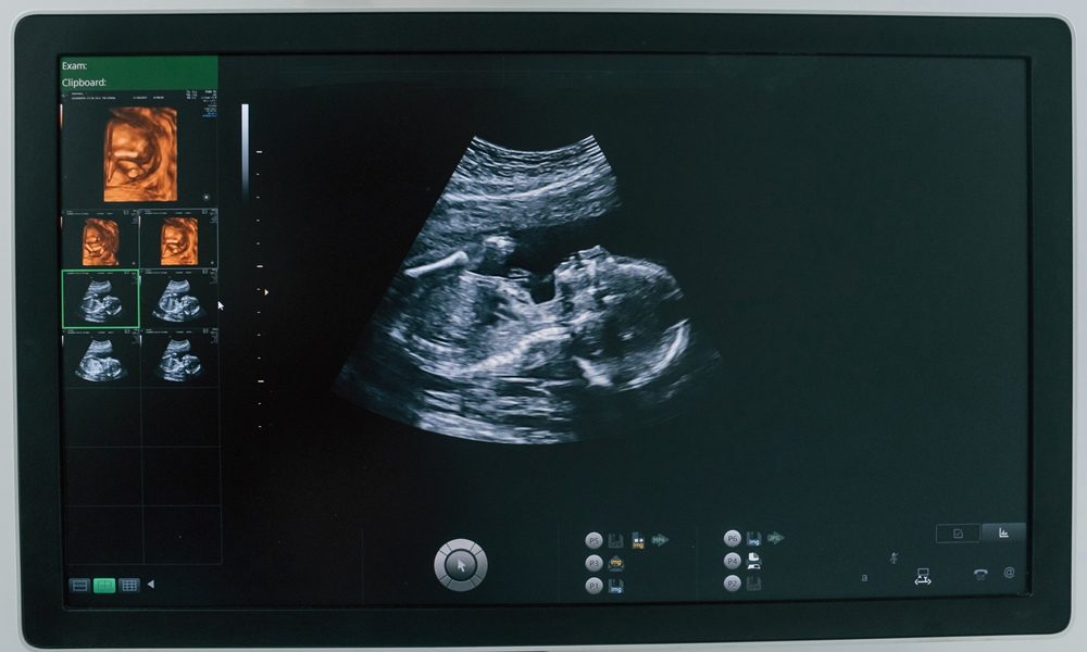 Unregulated pregnancy scans putting lives in danger, experts say