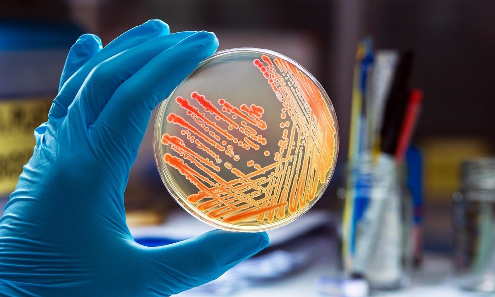 Female-led antimicrobial resistance startup secures €24 million