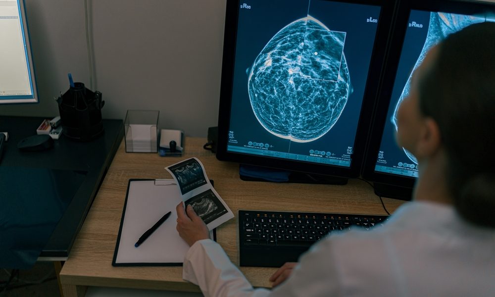 Heart disease risk found in mammograms
