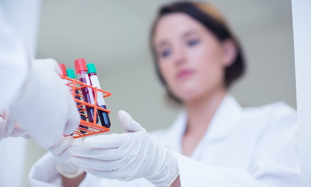 Blood test shows promise in endometriosis