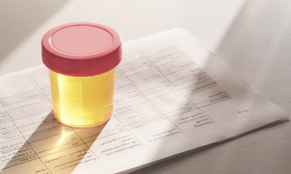 Home urine tests could detect breast cancer, endometriosis and PCOS