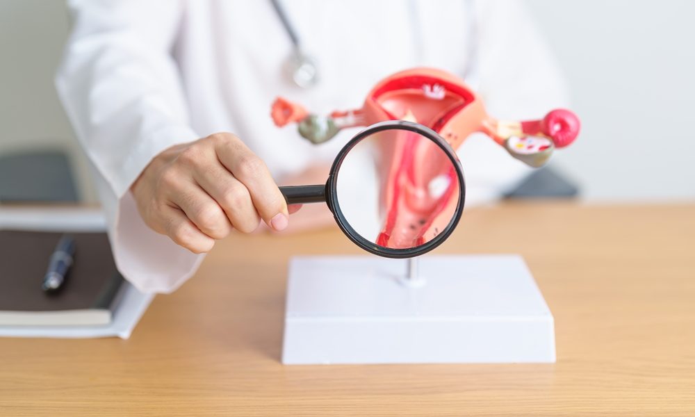 NHS urged to update website following renaming of PCOS