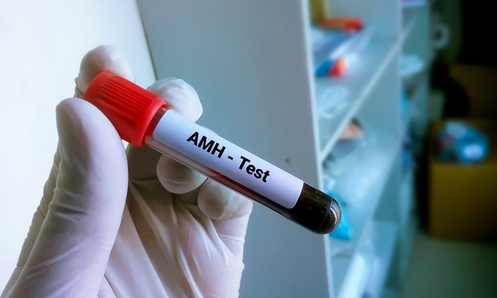 AMH testing: the most misunderstood number in fertility – what it can and can’t tell you