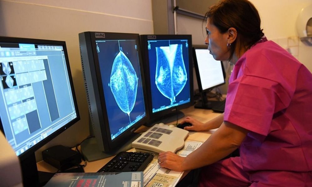 Lymph nodes could reveal who’s most at risk of breast cancer spreading