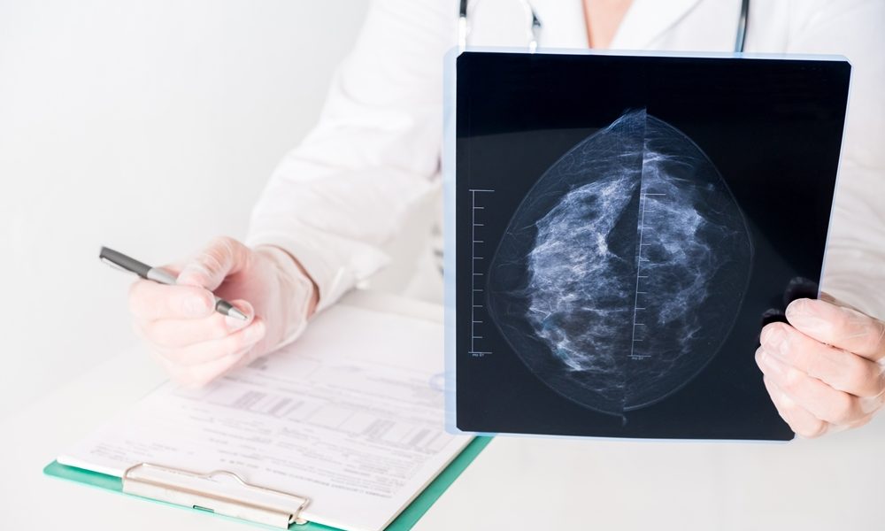 CEM shows promise for screening high-risk breast cancer patients