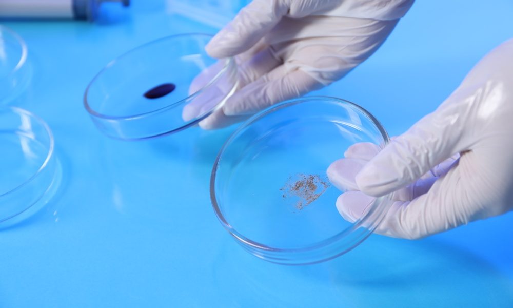 Scientist holding Petri dishes with samples on light blue background, closeup Juno Bio secures US$3.8m for precision diagnostics