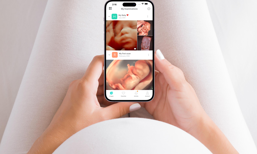Ultrasound Direct extends Trice Imaging partnership
