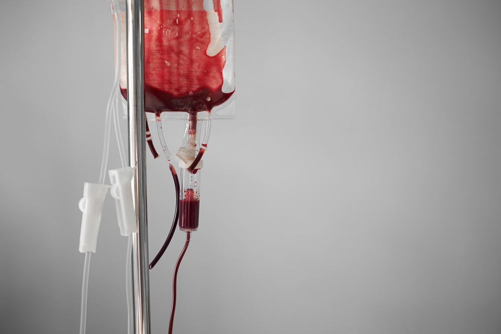 IV iron cuts transfusion rates in pregnancy anaemia