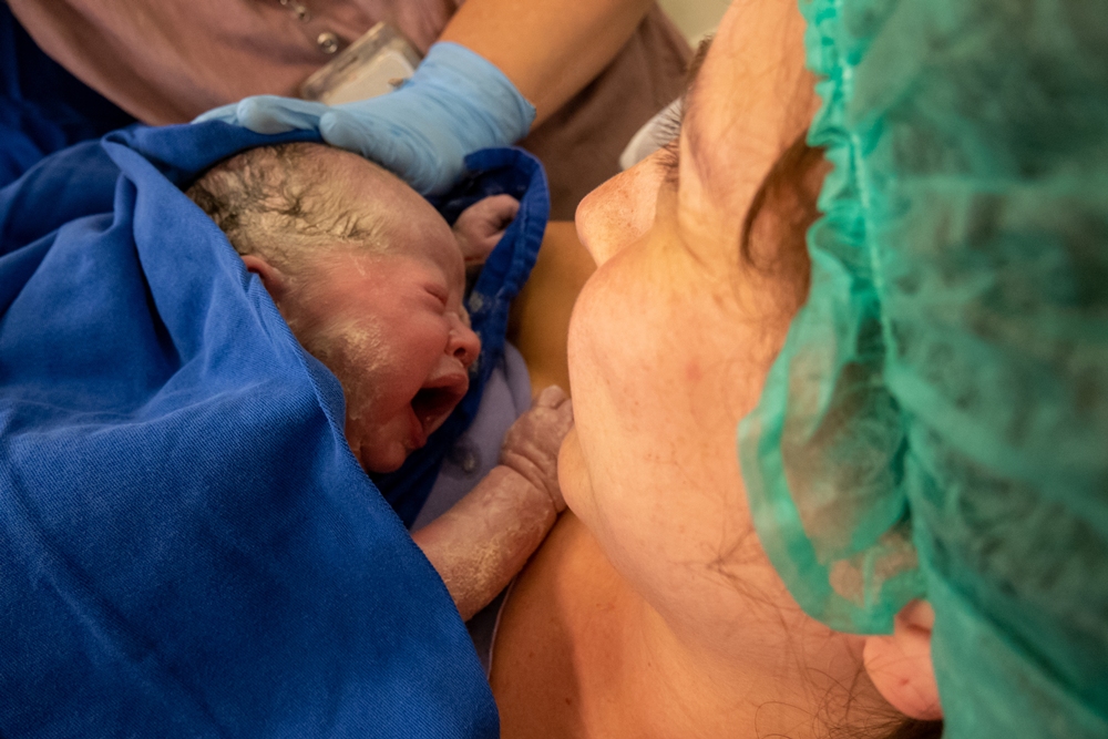 Chronic pain after caesarean delivery linked to ongoing poorer quality of life