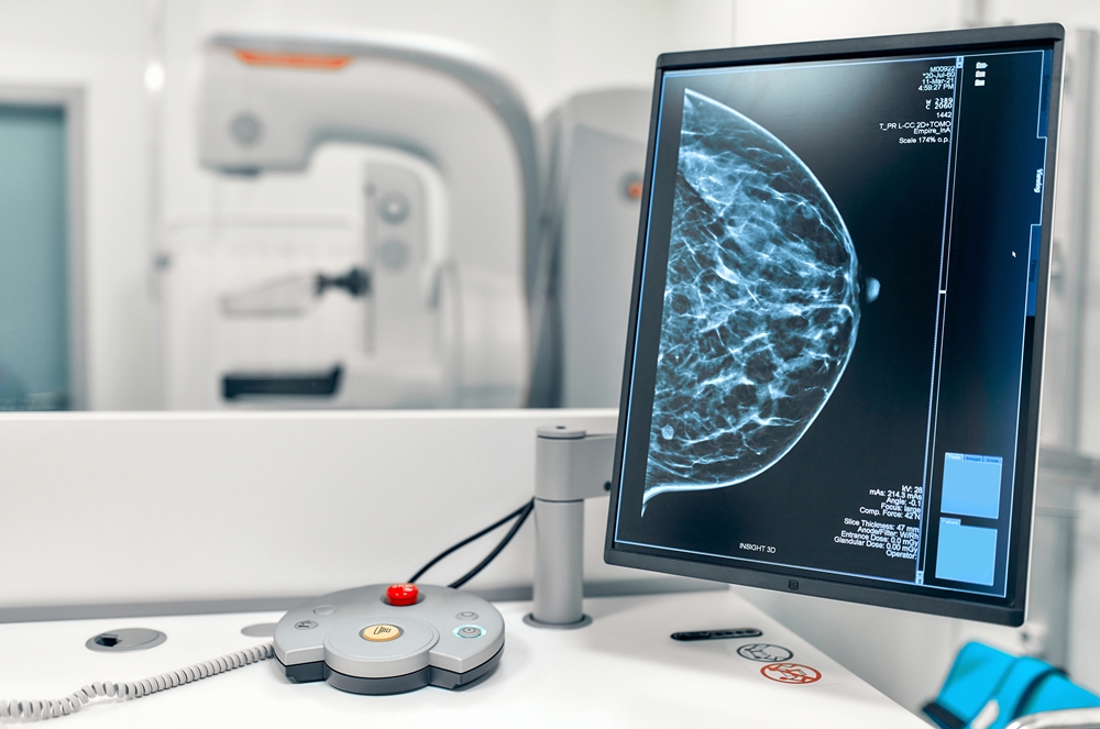 Cancer Risning Breast cancer rising among under-50s, charity warns