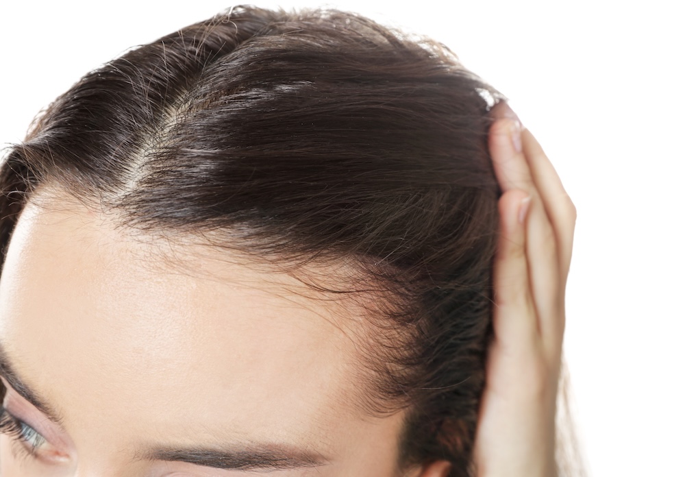 Hers launches hair loss service for UK women